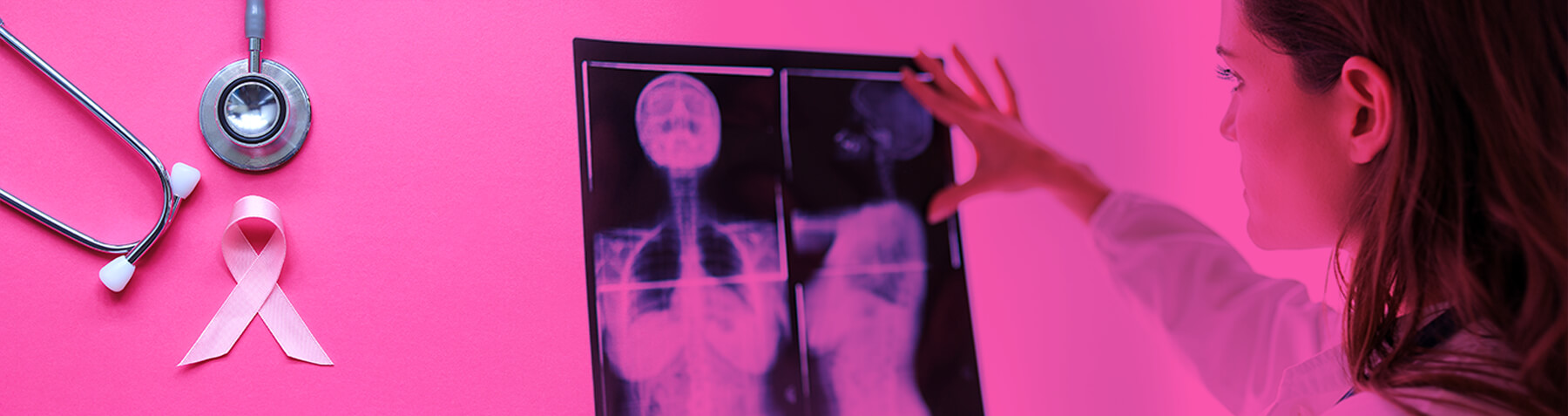 Breast Screening Claims